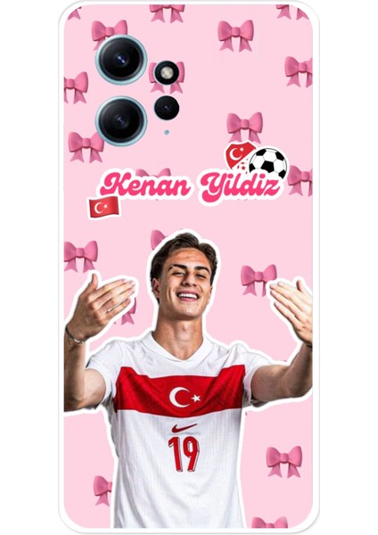 Redmi Note 12 4g Uyumlu Kenan Yıldız Kurdele Baskılı Silikon Kılıf