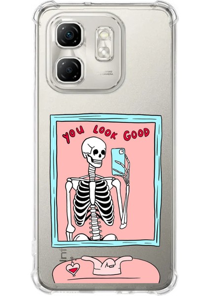 Infinix Hot 50I - Smart 9 Uyumlu You Look Good Iskelet Tasarımlı Baskılı Silikon Kılıf