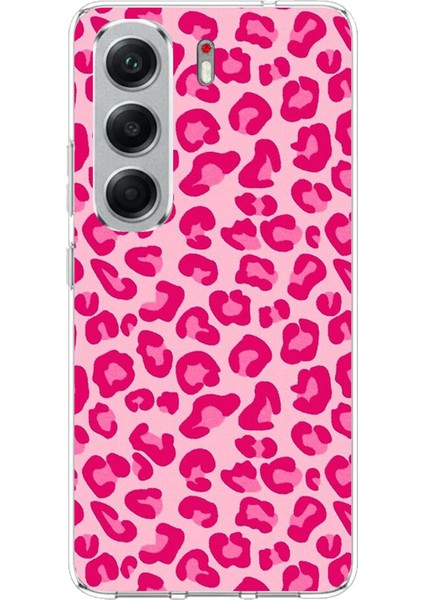 Tecno Camon 40 Pro Uyumlu Pembe Leopar Tasarımlı Baskılı Silikon Kılıf