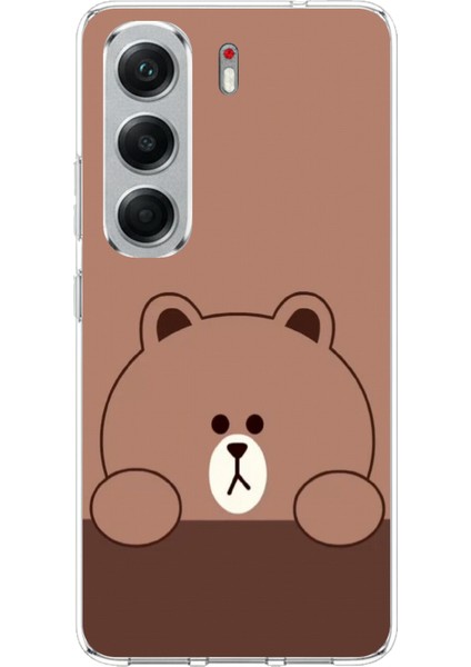 Tecno Camon 40 Pro Uyumlu Kahverengi Ayı Tasarımlı Baskılı Silikon Kılıf