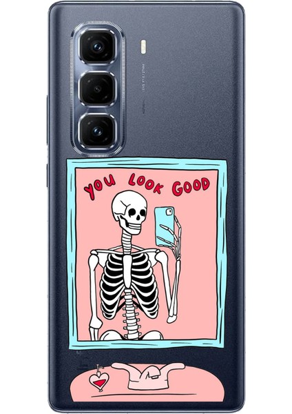 Infinix Hot 50 Pro Plus Uyumlu You Look Good Iskelet Tasarımlı Baskılı Silikon Kılıf