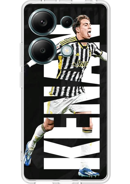 Redmi Note 13 Pro 4g Uyumlu Kenan Yıldız Sevinç Baskılı Silikon Kılıf