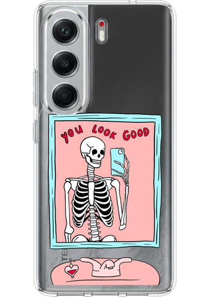Tecno Camon 40 Uyumlu You Look Good Iskelet Tasarımlı Baskılı Silikon Kılıf