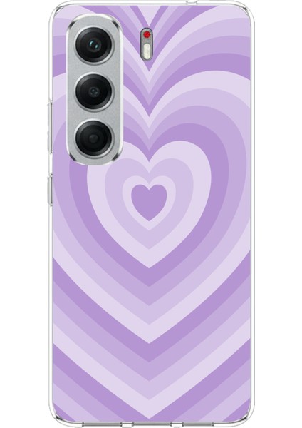 Tecno Camon 40 Pro Uyumlu Mor Kalp Dalgalar Tasarımlı Baskılı Silikon Kılıf