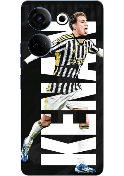 Tecno Camon 20 - 20 Pro 4g Uyumlu Kenan Yıldız Sevinç Baskılı Silikon Kılıf