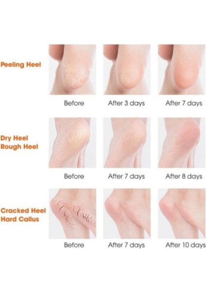 Topuk Kısmı Jel Silikonlu, Topuk Nemlendirici, Çatlak Giderici, Yarım Çorap (1 Çift) modelleri