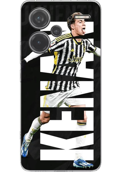 Redmi Note 13 Pro Plus 5g Uyumlu Kenan Yıldız Sevinç Baskılı Silikon Kılıf