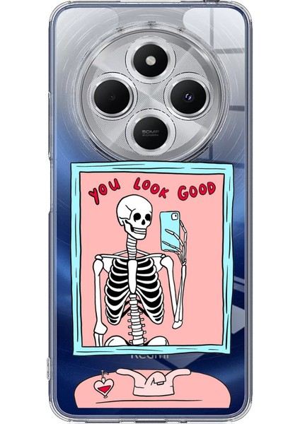 Redmi 14C Uyumlu You Look Good Iskelet Tasarımlı Baskılı Silikon Kılıf