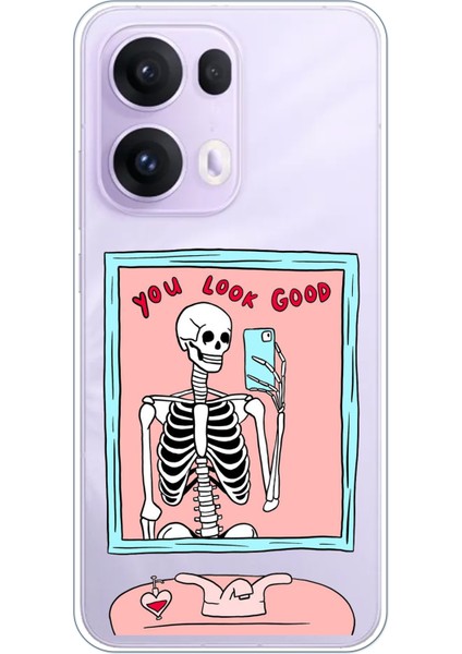 Oppo Reno 13 Pro Uyumlu You Look Good Iskelet Tasarımlı Baskılı Silikon Kılıf