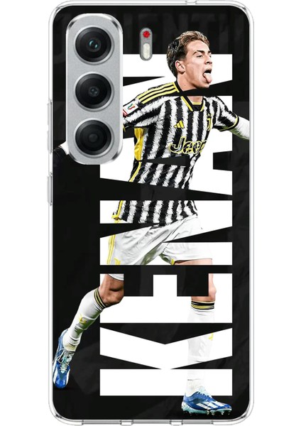 Tecno Camon 40 Pro Uyumlu Kenan Yıldız Sevinç Baskılı Silikon Kılıf