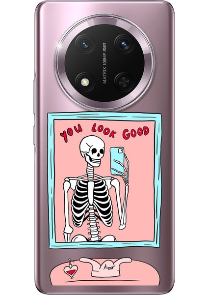 Honor Magic 7 Lite Uyumlu You Look Good Iskelet Tasarımlı Baskılı Silikon Kılıf