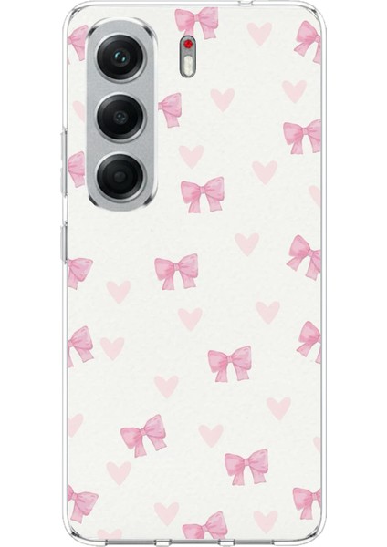 Tecno Camon 40 Pro Uyumlu Fiyonklar ve Pembe Kalpler Baskılı Silikon Kılıf