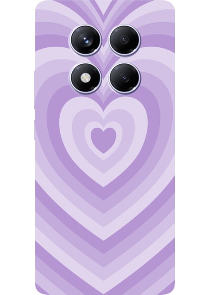 Redmi Note 14 Pro Plus 5g Uyumlu Mor Kalp Dalgalar Tasarımlı Baskılı Silikon Kılıf