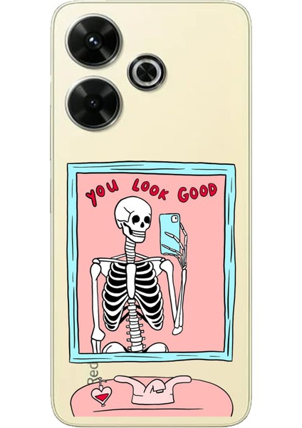 Redmi 13 Uyumlu You Look Good Iskelet Tasarımlı Baskılı Silikon Kılıf