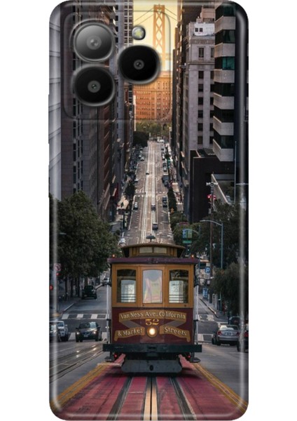 Omix X7 Kılıf Silikon Tasarım Stok California