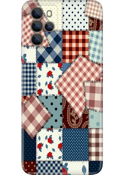 Omix X700 Kılıf Hd Silikon Yama