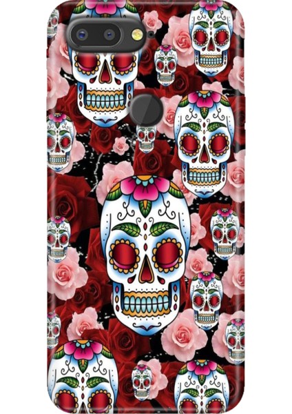 General Mobile Gm 9 Pro Kılıf Desenli Esnek Silikon Kapak Uv Kabile