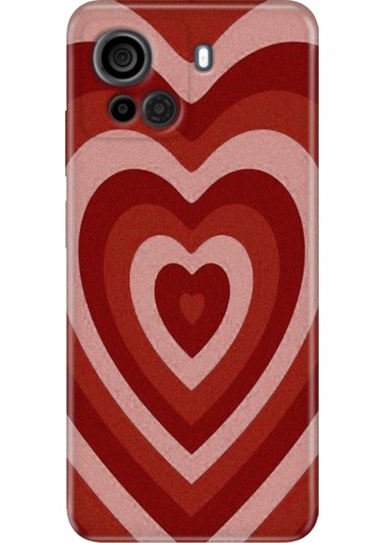 Casper Via F30 Uyumlu Kılıf Desenli Silikon Renkli Tpu Uv Mat Kalp