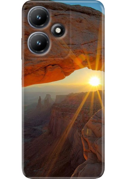 Infinix Hot 30 Kılıf Baskılı Esnek Silikon Kapak Sun