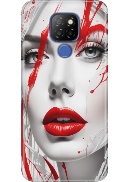 General Mobile Gm 20 Kılıf Desenli Silikon Case Uv Lady