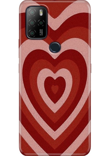 Omix X300 / Omix X500 Kılıf Hd Silikon Mat Kalp