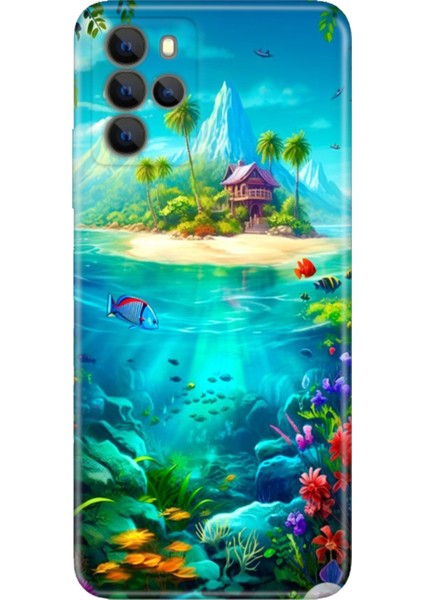 Omix X700 Kılıf Hd Silikon Island