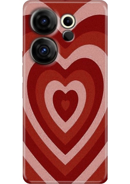 Tecno Camon 20 Premier 5g Kılıf (CK9N) Uyumlu Desenli Silikon Mat Kalp