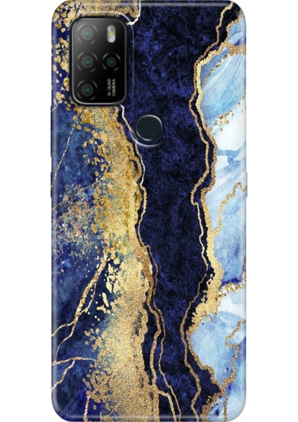 Omix X300 / Omix X500 Kılıf Hd Silikon Hillmermer