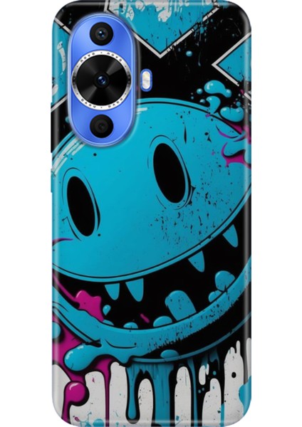 Huawei Nova 12S Kılıf Desenli Kapak Renkli Tpu Uv Vintage Wall