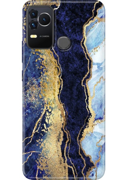 Omix X400 Kılıf Renkli Esnek Silikon Hillmermer