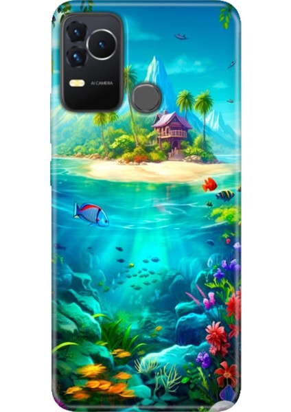 Omix X400 Kılıf Renkli Esnek Silikon Island