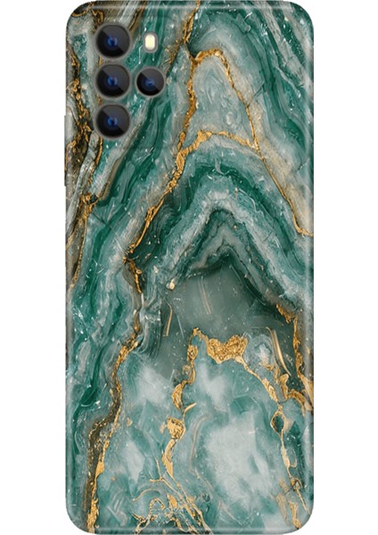 Omix X700 Kılıf Hd Silikon Granit