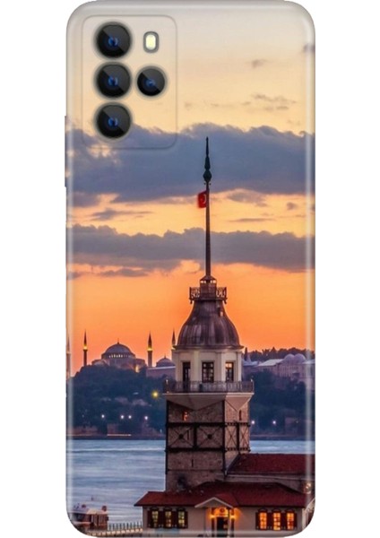 Omix X700 Kılıf Hd Silikon Kız Kulesi