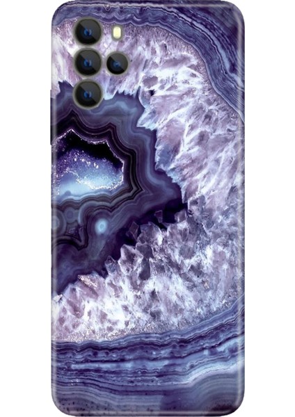 Omix X700 Kılıf Hd Silikon Elmas