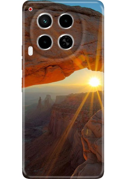 Tecno Camon 30 Kılıf (Cl6) Uyumlu Silikon Desenli Kapak Sun