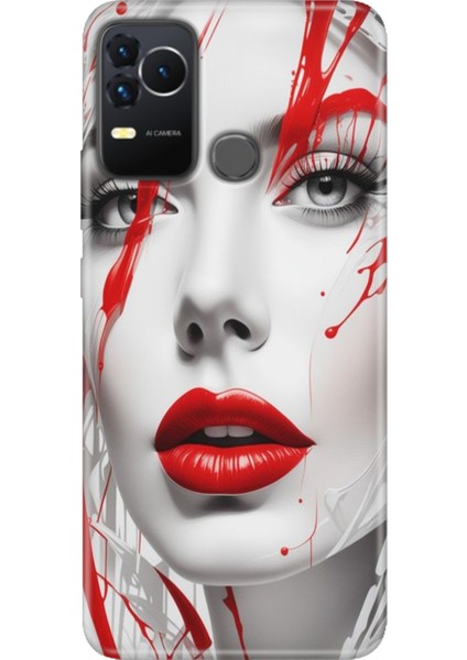 Omix X400 Kılıf Renkli Esnek Silikon Lady