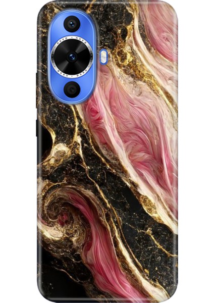 Huawei Nova 12S Kılıf Desenli Kapak Renkli Tpu Uv Seattle Mermer