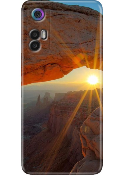 Tcl 30+ (Plus) Kılıf Silikon Renkli Resimli Arka Kapak Sun