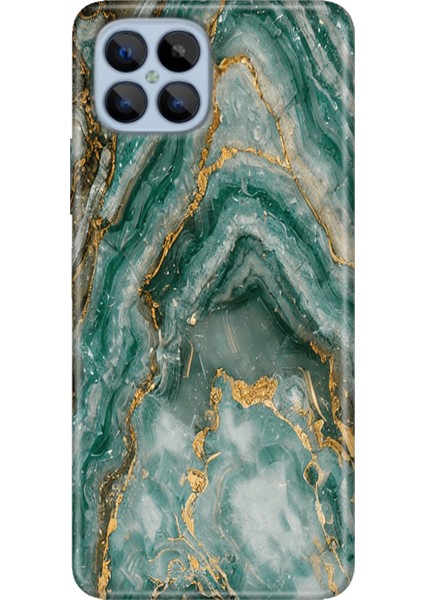 Omix X600 Kılıf Renkli Esnek Silikon Granit