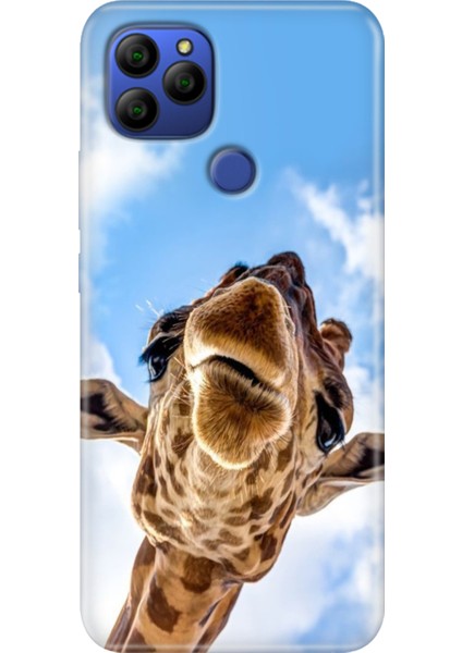 General Mobile Gm 21 G310 Kılıf Baskılı Silikon Case Öpücük