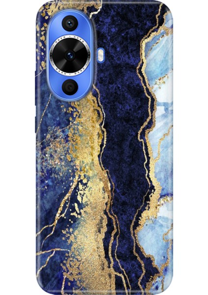 Huawei Nova 12S Kılıf Desenli Kapak Renkli Tpu Uv Hillmermer