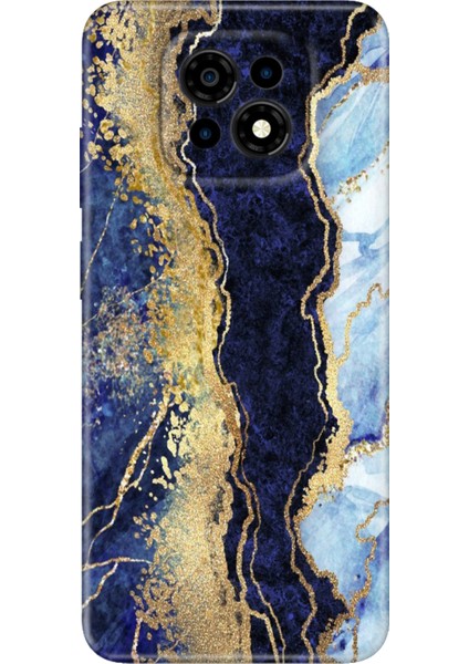 Casper Via M30 Kılıf Outlet Desenli Ermer Kapak Silikon Hillmermer