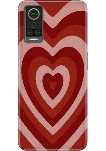 General Mobile Gm 22 Pro Kılıf Hd Desenli Esnek Silikon Mat Kalp