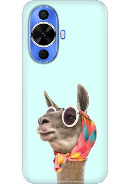 Huawei Nova 12S Kılıf Desenli Kapak Renkli Tpu Uv Deve