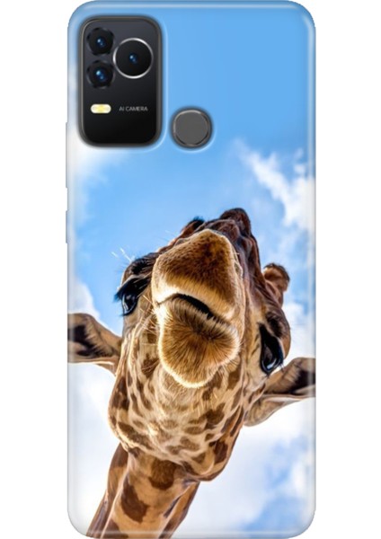 Omix X400 Kılıf Renkli Esnek Silikon Öpücük