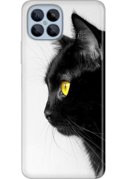 Omix X600 Kılıf Renkli Esnek Silikon Kedi Bakışı