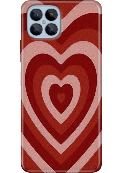 Omix X600 Kılıf Renkli Esnek Silikon Mat Kalp