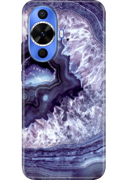 Huawei Nova 12S Kılıf Desenli Kapak Renkli Tpu Uv Elmas