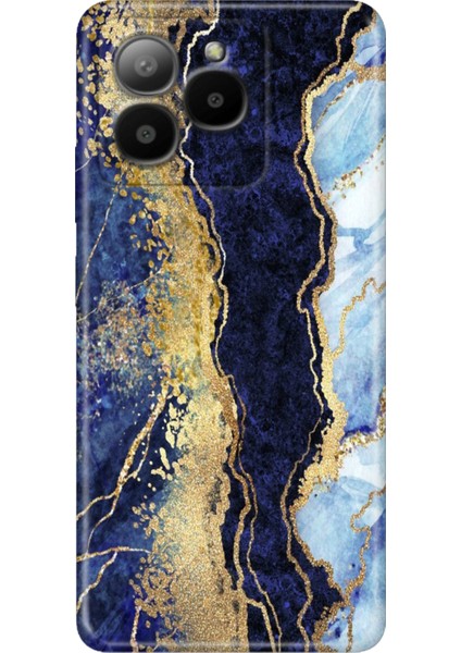 Omix X7 Kılıf Silikon Tasarım Stok Hillmermer