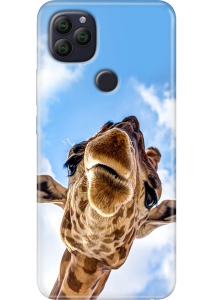 General Mobile Gm 22 - 22S Kılıf Desenli Rubber Silikon Öpücük